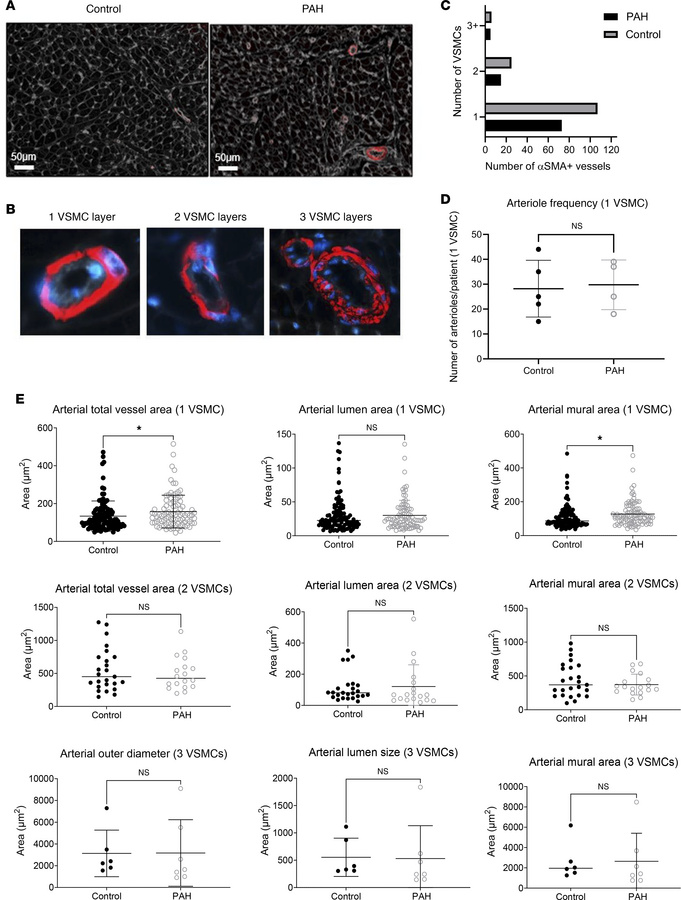 Histological analysis of vascular density and arteriole morphology.
(A) ...