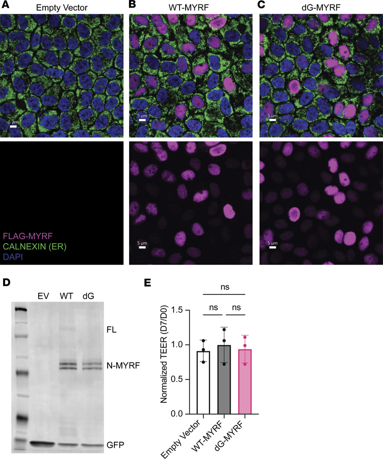 Processing and functional studies of C-terminal MYRF variant in human pr...