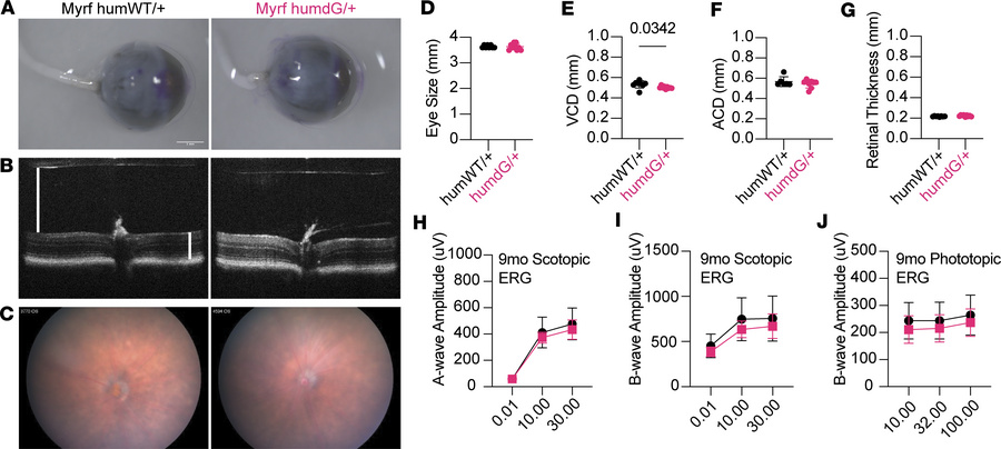 Heterozygous MyrfhumdG/+ mice show no gross morphological or retinal eye...