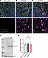 Processing and functional studies of C-terminal MYRF variant in human prima