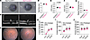 Heterozygous MyrfhumdG/+ mice show no gross morphological or retinal eye ph