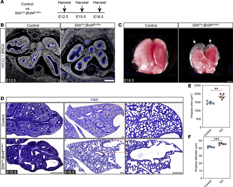 Endodermal BRD4 is required for lung morphogenesis and perinatal surviva...