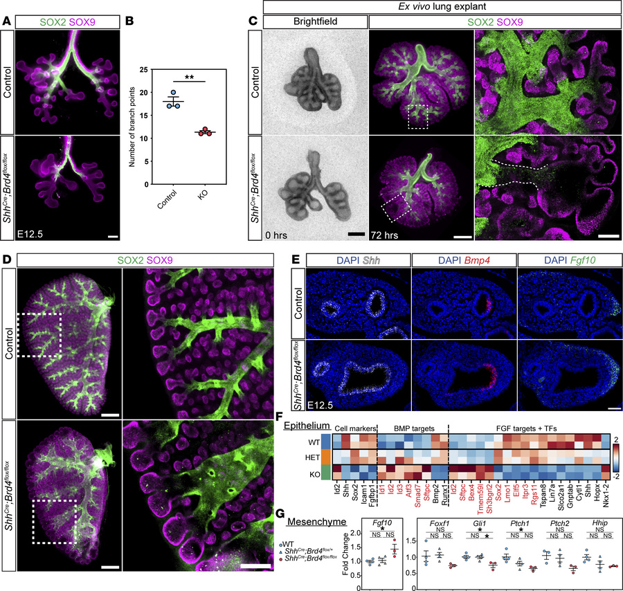 Loss of endodermal BRD4 disrupts epithelial-mesenchymal crosstalk.
(A an...