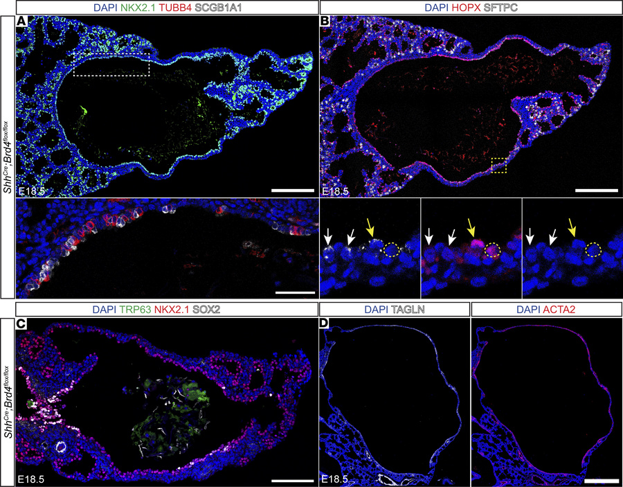 Loss of endodermal BRD4 results in impaired epithelial cell differentiat...