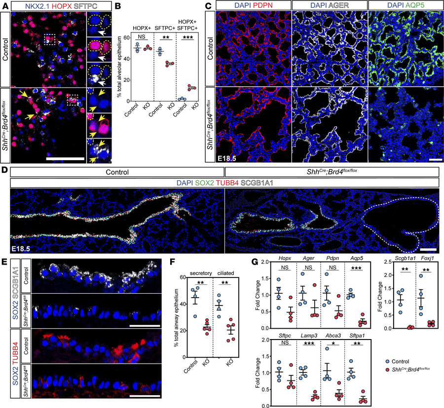 BRD4 is required for proximal and distal airway epithelial cell differen...