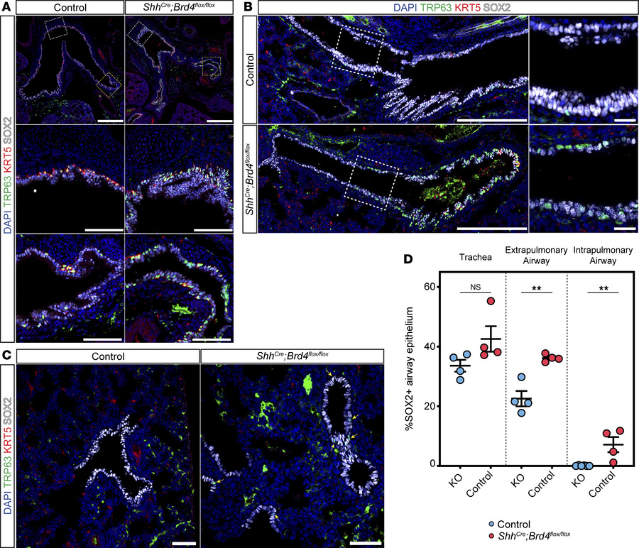 BRD4 promotes lung basal cell differentiation in extra- and intrapulmona...