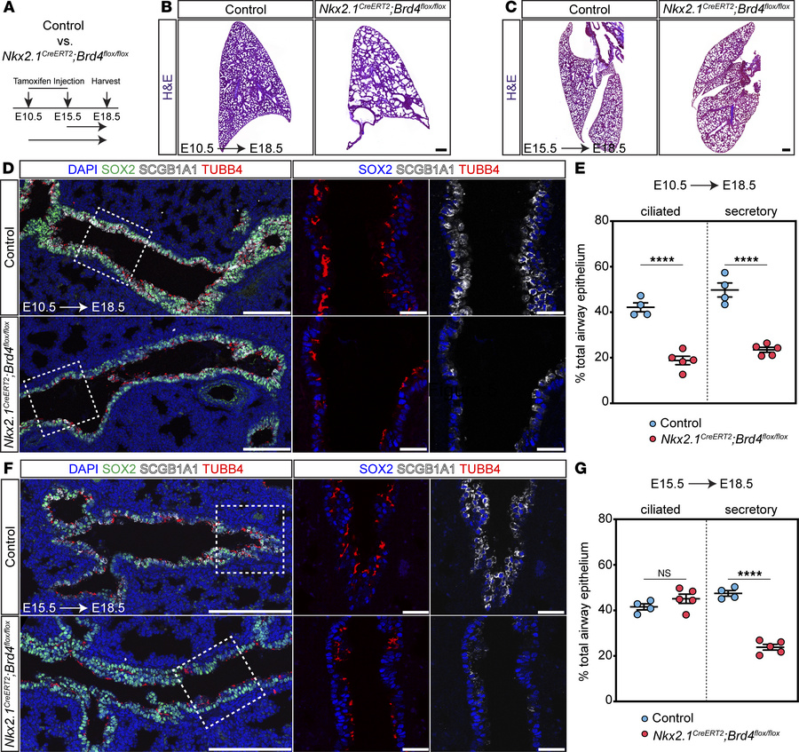 BRD4 regulates temporal acquisition of lung endodermal cell fate.
(A) Ex...