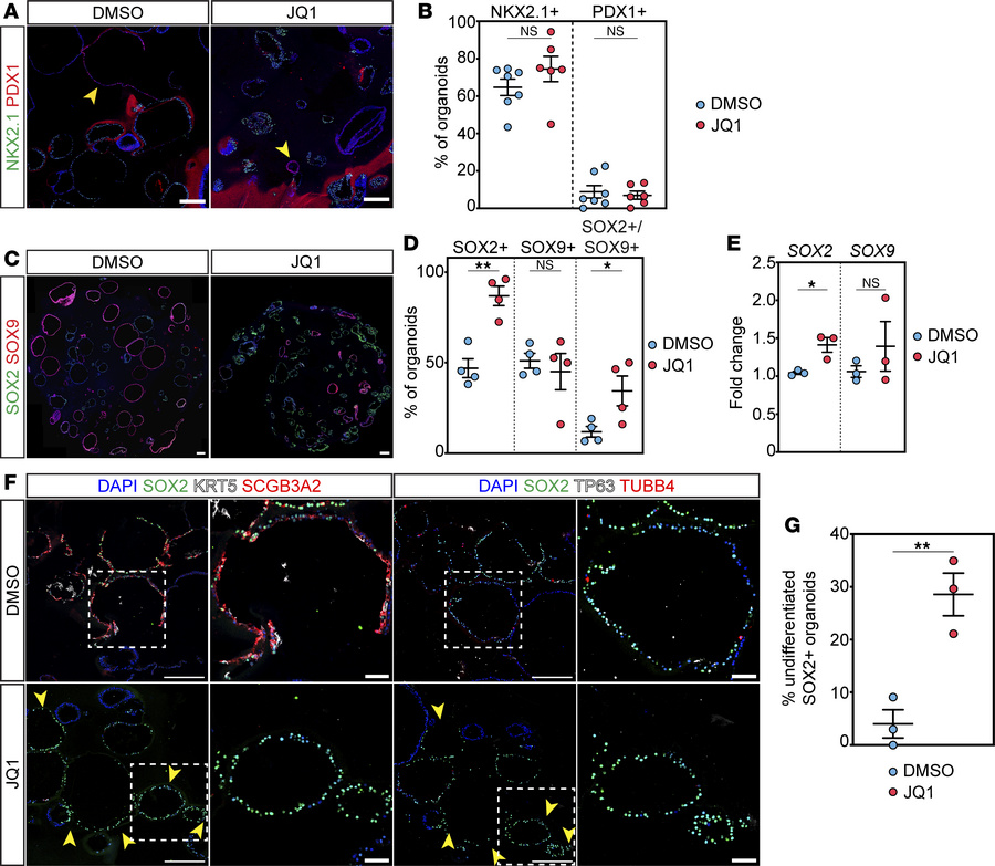 BRD4 bromodomain inhibition sequesters hESC-derived lung endodermal orga...
