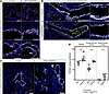 BRD4 promotes lung basal cell differentiation in extra- and intrapulmonary