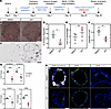 BRD4 bromodomains inhibition disrupts hESC-derived lung endodermal cell fat