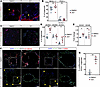 BRD4 bromodomain inhibition sequesters hESC-derived lung endodermal organoi