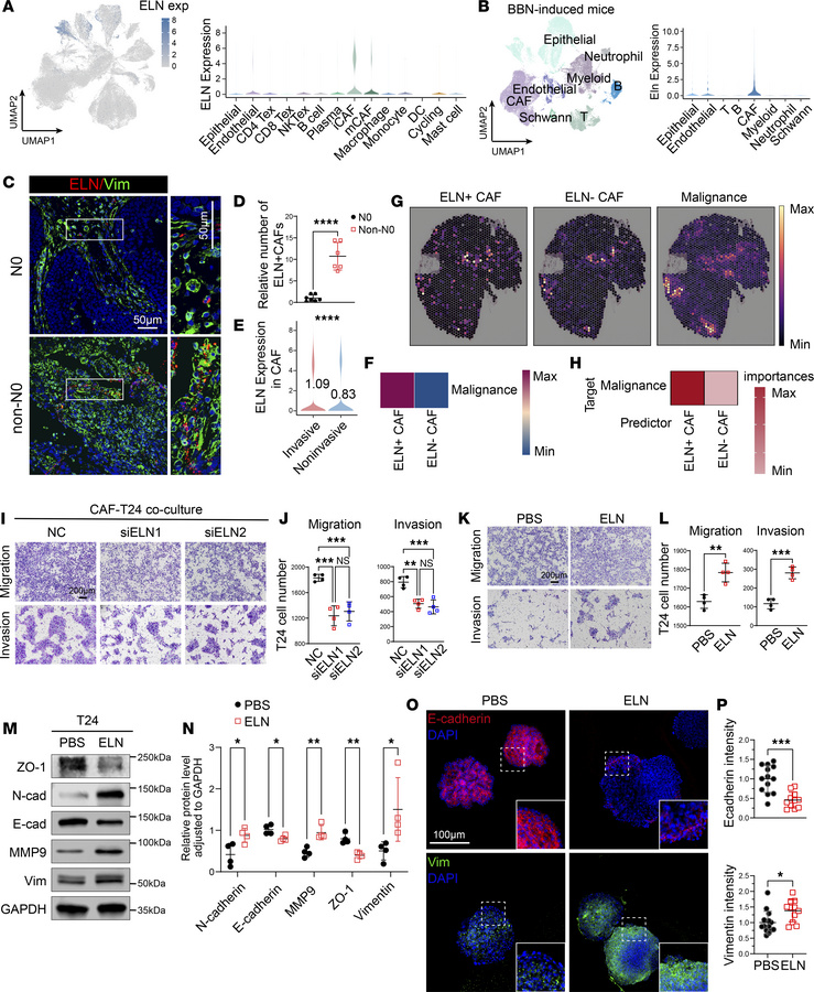 ELN+ CAFs promotes metastatic niche in BCa.
(A) ELN expression across ce...