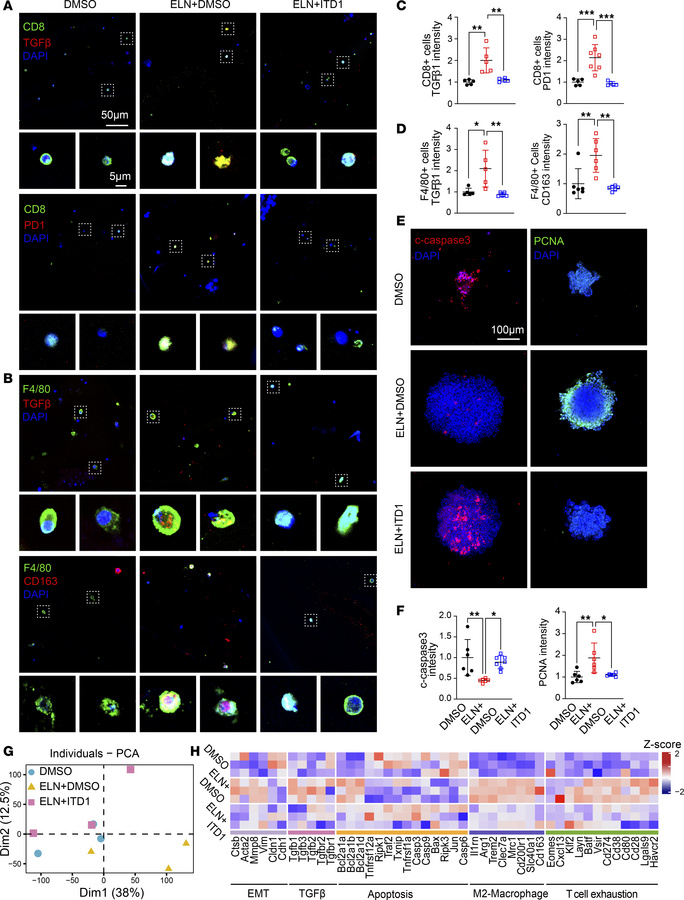 ELN promotes immunosuppressive immune cell subsets through TGF-β1 produc...