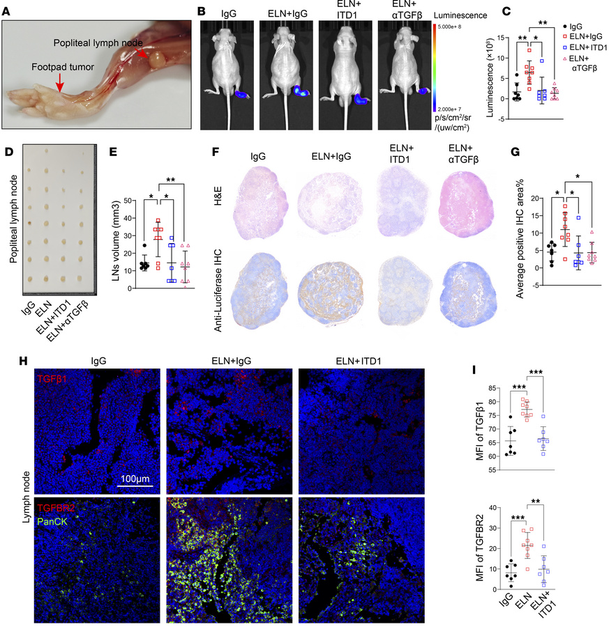 ELN/TGFBR2 axis accelerates BCa lymph node metastasis.
(A) Schematic of ...