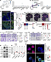 ELN+ CAFs promotes metastatic niche in BCa.