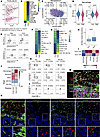 ELN+ CAFs shape an immunosuppressive microenvironment characterized by T ce