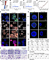 ELN directly binds TGFBR2 and activates TGF-β1 autocrine signaling in tumor