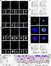 ELN promotes immunosuppressive immune cell subsets through TGF-β1 productio