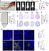 ELN/TGFBR2 axis accelerates BCa lymph node metastasis.