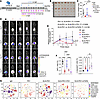 Targeting the ELN/TGFBR2 axis improves the immunotherapeutic response in vi