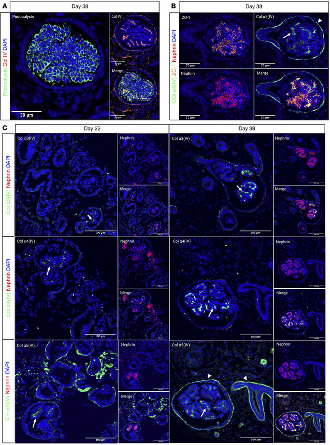 Immunofluorescence staining of kidney organoids highlighting the localiz...