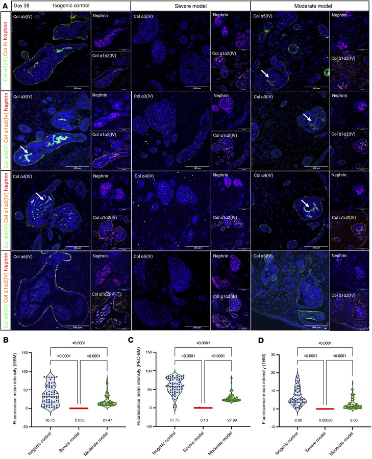 Analysis of BM defects in XLAS.
(A) Immunofluorescence staining for coll...