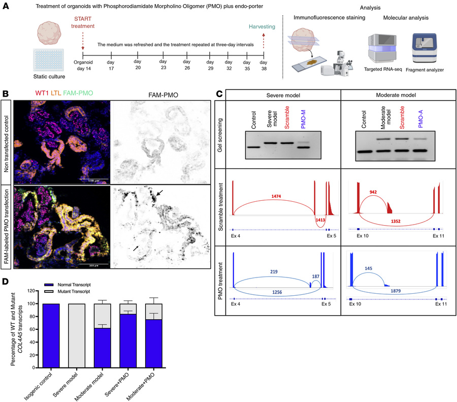 Successful restoration of aberrant splicing in XLAS organoid models by a...
