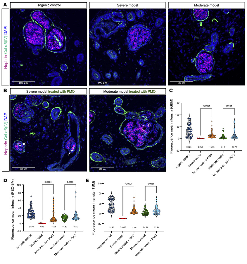 Restoration of BM collagen network in XLAS organoid models following spl...