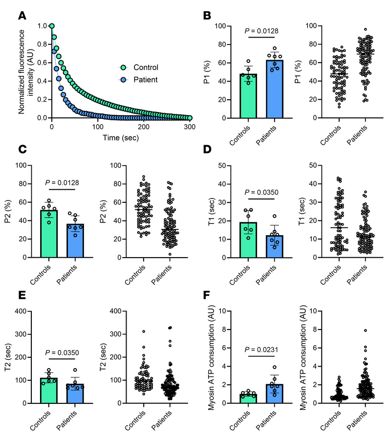 Myosin biochemical and energetic states in patients with XLMTM.
(A) Typi...