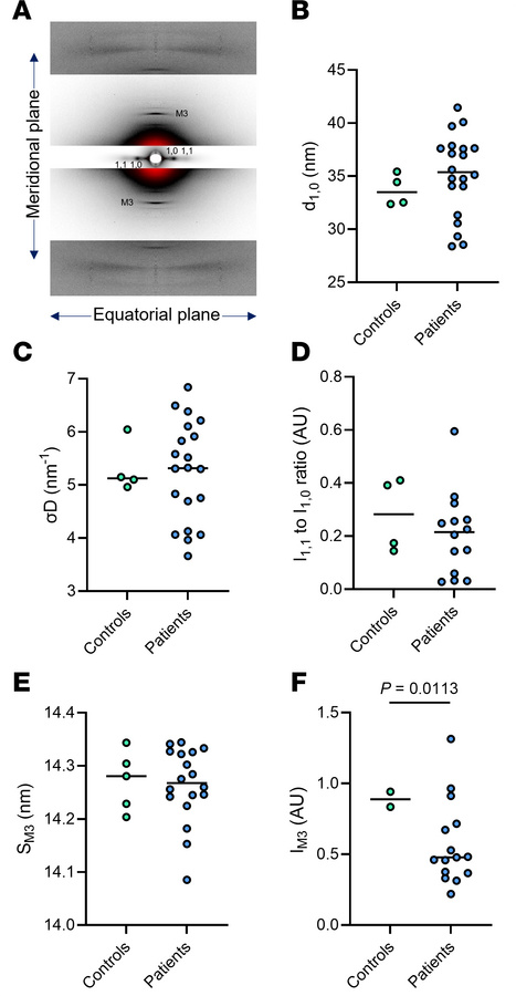Myofilament and myosin order in patients with XLMTM.
(A) A typical x-ray...