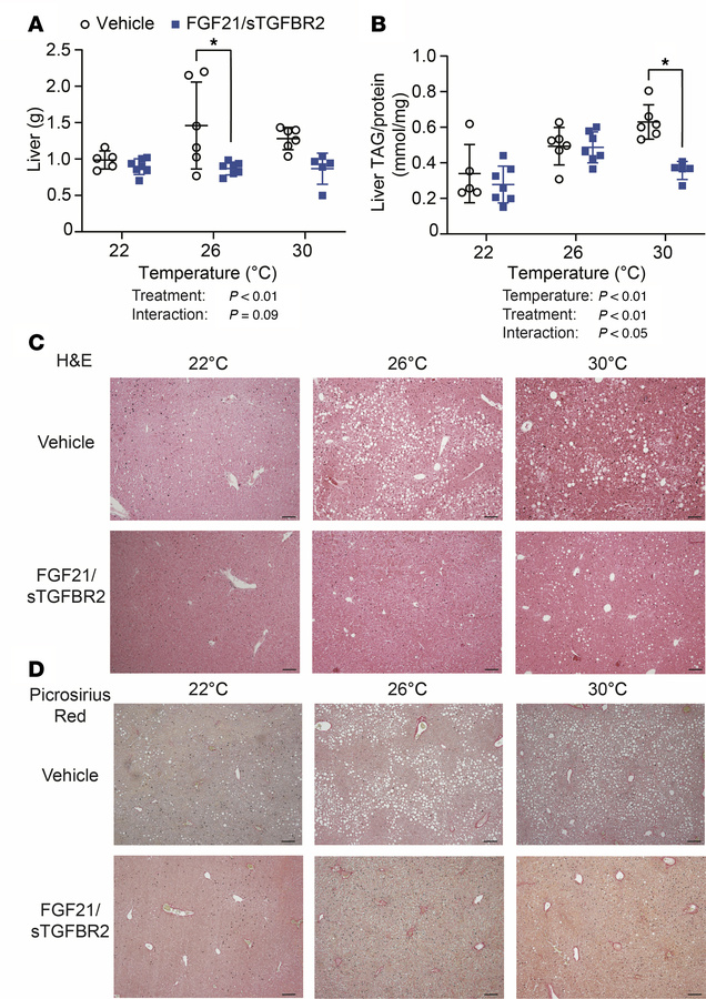 FGF21/sTGFBR2 decreases liver weights and hepatic steatosis, with highes...