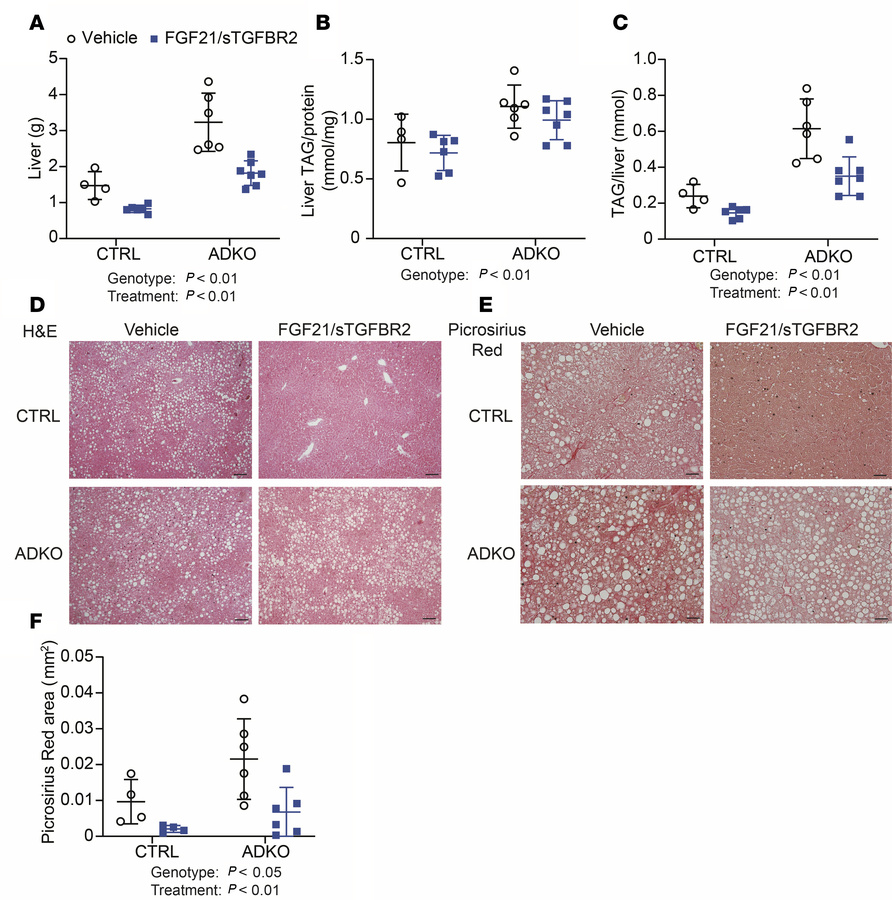 FGF21/sTGFBR2 reduces liver weight, total hepatic TAG, and liver collage...