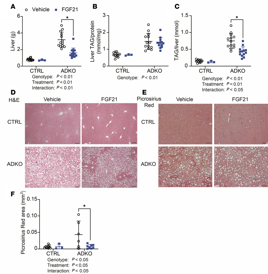 FGF21 reduces liver weight, total hepatic TAG content, and liver collage...