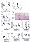 FGF21/sTGFBR2 decreases adiposity and plasma insulin concentrations, with h