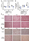 FGF21/sTGFBR2 decreases liver weights and hepatic steatosis, with highest e