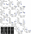 FGF21/sTGFBR2 does not improve metabolic dysfunction of lipodystrophic mice
