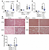 FGF21 reduces liver weight, total hepatic TAG content, and liver collagen d