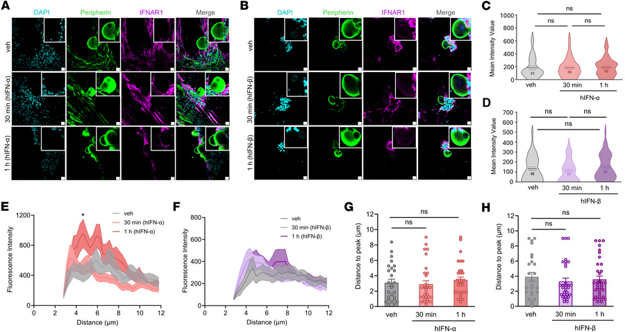 IFNAR1 protein expression in cultured hDRG neurons and response to type ...