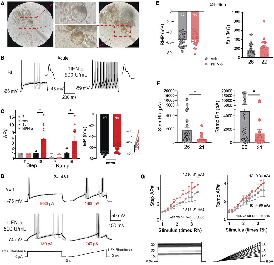 hIFN-α increases the excitability of hDRG neurons.
(A) Pictures of recor...