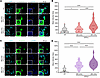 Type I IFN induction of STAT1 signaling in the nuclear compartment of hDRG