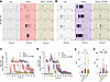 Type I IFNs increase the frequency of APs in hDRG neurons, and the MNK inhi