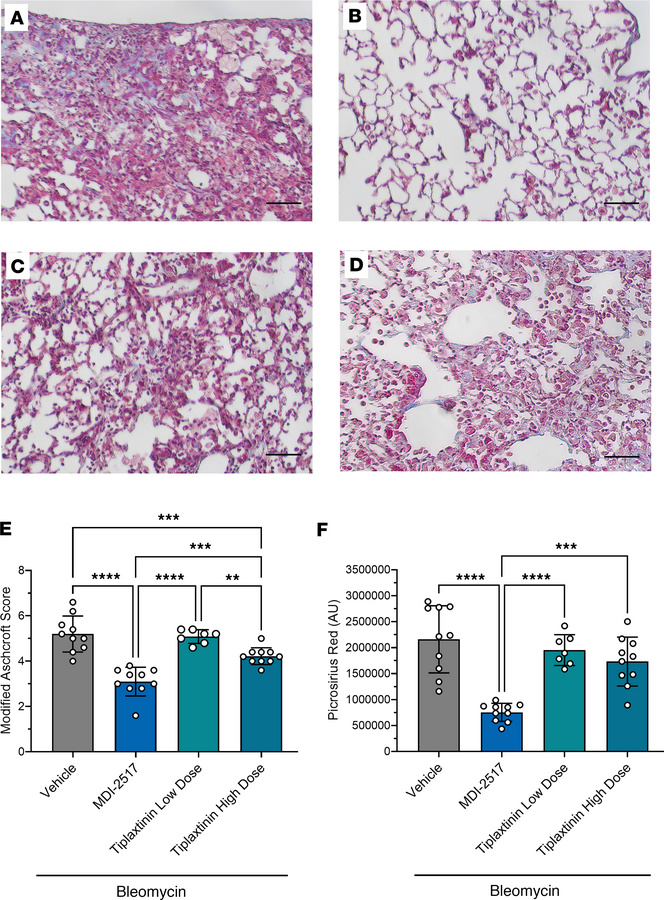 Lung trichrome staining from the comparator study of MDI-2517 and low-do...
