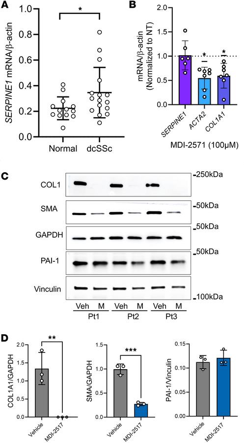 Downregulation of profibrotic markers in human SSc fibroblasts by MDI-25...