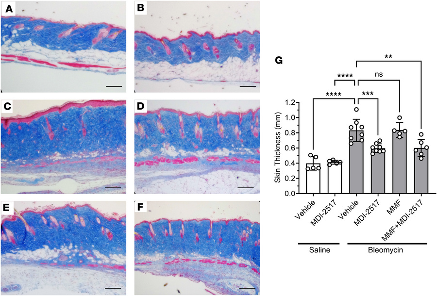 Skin trichrome staining from the comparator study of MDI-2517, MMF, and ...