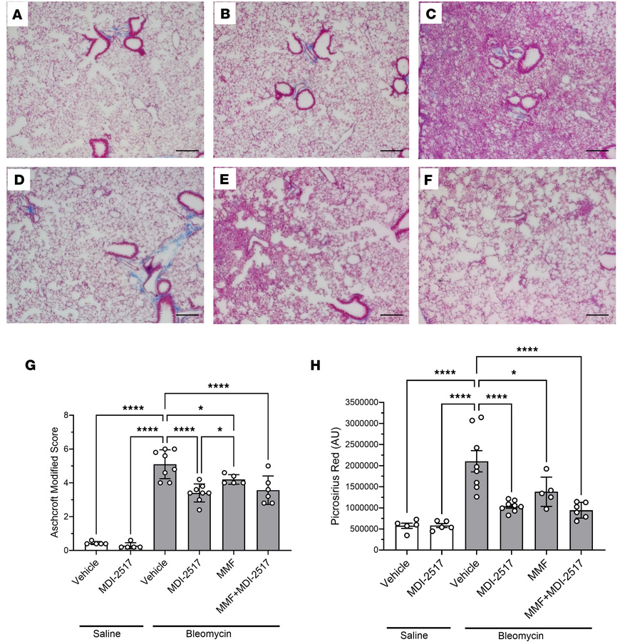 Lung trichrome staining from the comparator study of MDI-2517, MMF, and ...