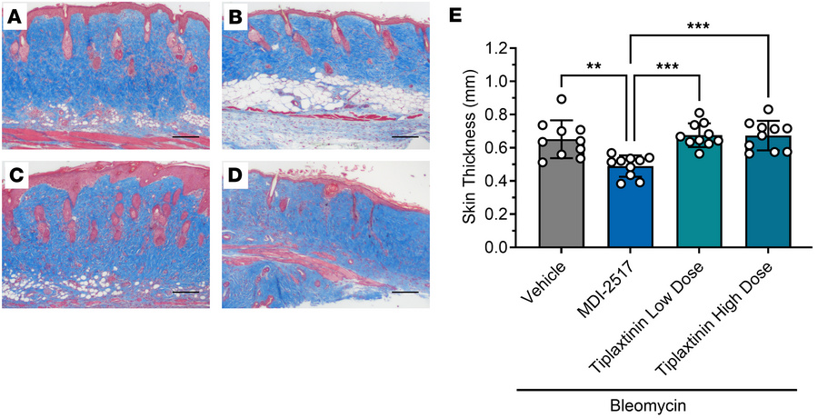 Skin thickness by Masson’s trichrome from comparator study of MDI-2517 a...