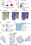 Expression of PAI-1 in SSc skin.