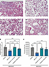Lung trichrome staining from the comparator study of MDI-2517 and low-dose