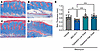 Skin thickness by Masson’s trichrome from comparator study of MDI-2517 and