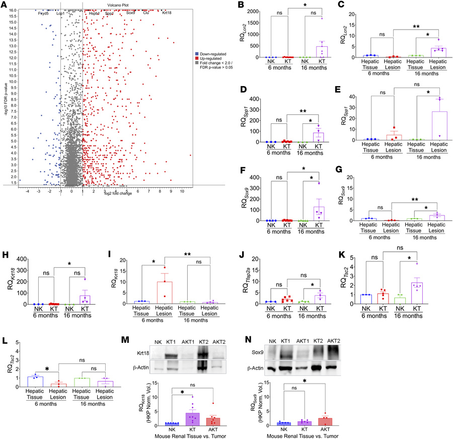 Neurocristopathic markers of renal tumorigenesis in Tsc2+/– mice.
(A) DE...